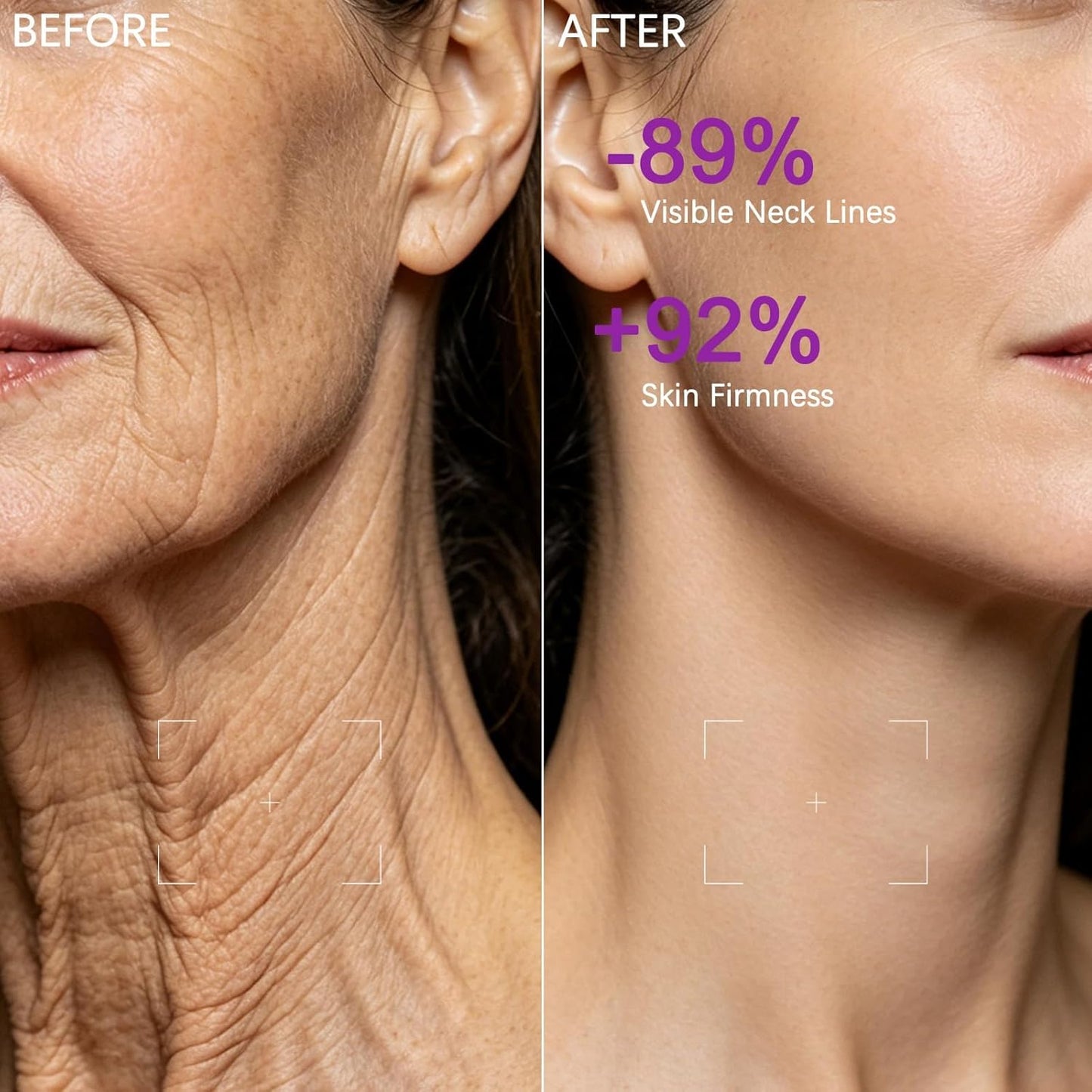 Advanced Collagen V-Roller Neck Cream